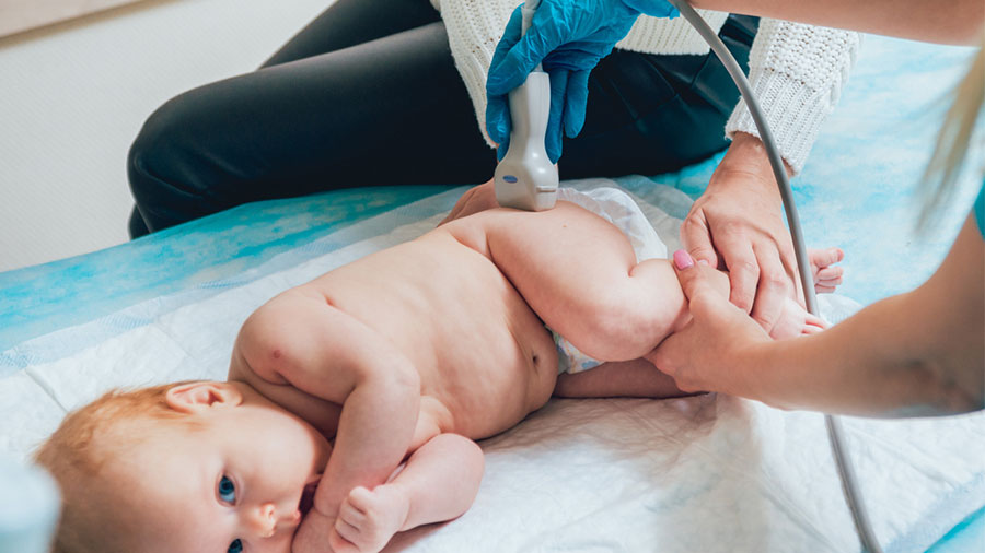 Bebeklerde Kalça Ultrasonu